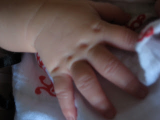 Knuckle Dimples