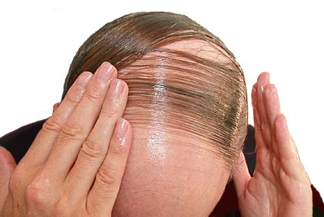 [04_05_combover.jpg]