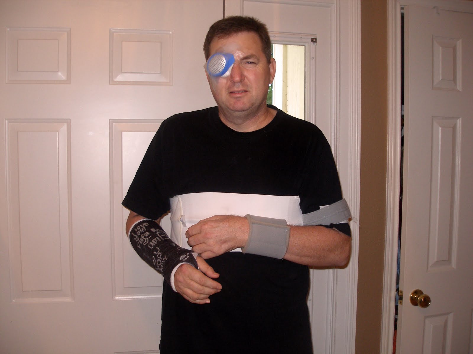 [After+eye+surgery.jpg]