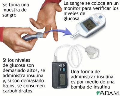 Como adelgazar mí las nalgas