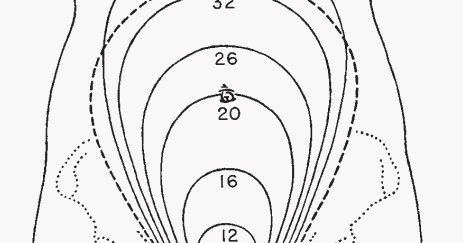 NCLEX and CGFNS - MATERNITY NURSING: Fundal Height Assessment