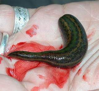 leeches in medicine Download citation | leeches in medicine | leeches have been used in medicine for blood-letting since ancient times leeching has varied in popularity over the years. leeches in medicine Download citation | leeches in medicine | leeches have been used in medicine for blood-letting since ancient times leeching has varied in popularity over the years.