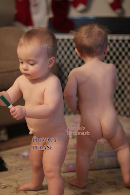 Birthmark On Hip