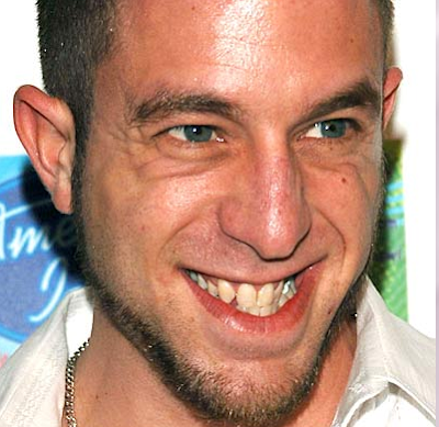 Ugly Celebrity Smiles!