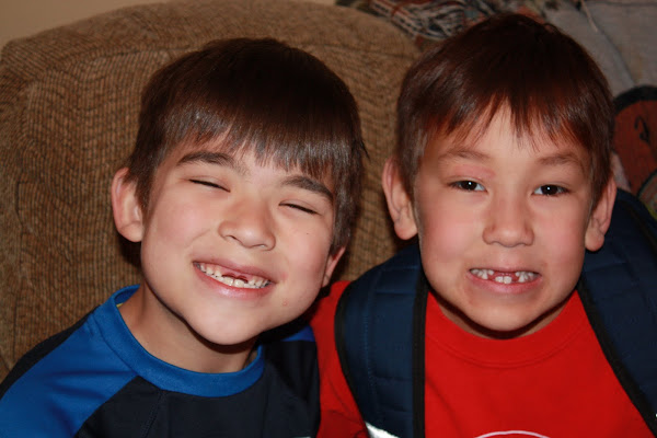 Snaggle-tooth boys