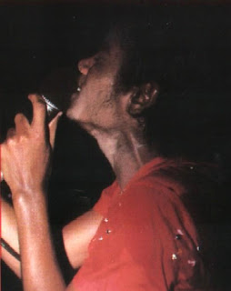 michael vitiligo