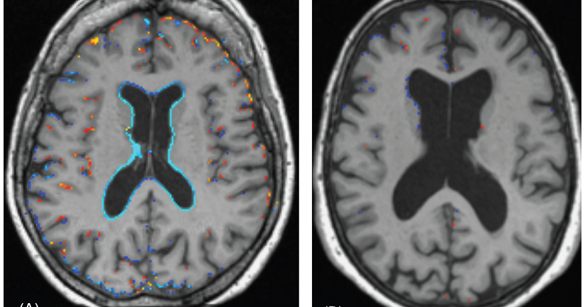 buy neurological rehabilitation