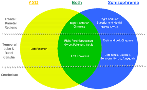 Brain Posts: Common Brain Anatomy Features in Autism and Schizophrenia