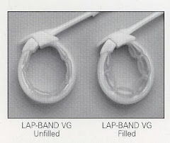 Deflated and filled bands