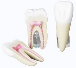 [teeth-model.jpg]