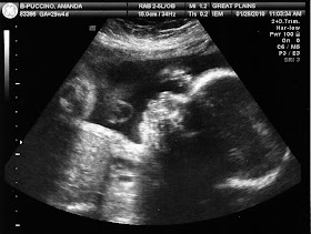ultrasound bear