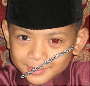 EYES SHOW FROM AEK