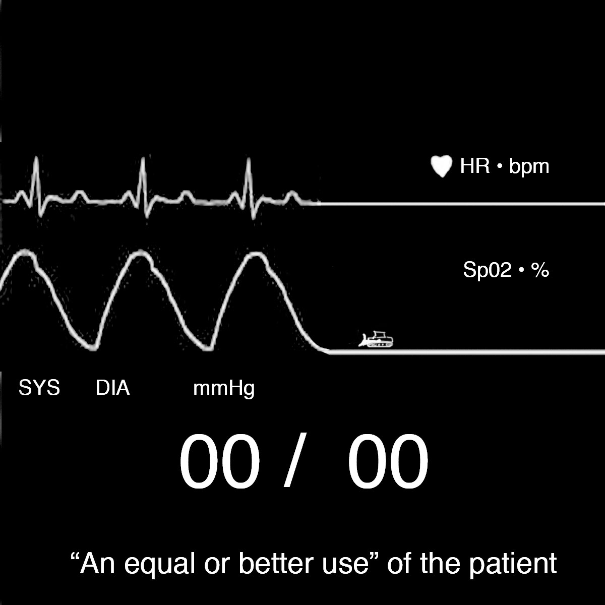 [OE6bflatline.jpg]