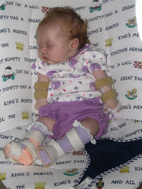 First leg splint and arm splints