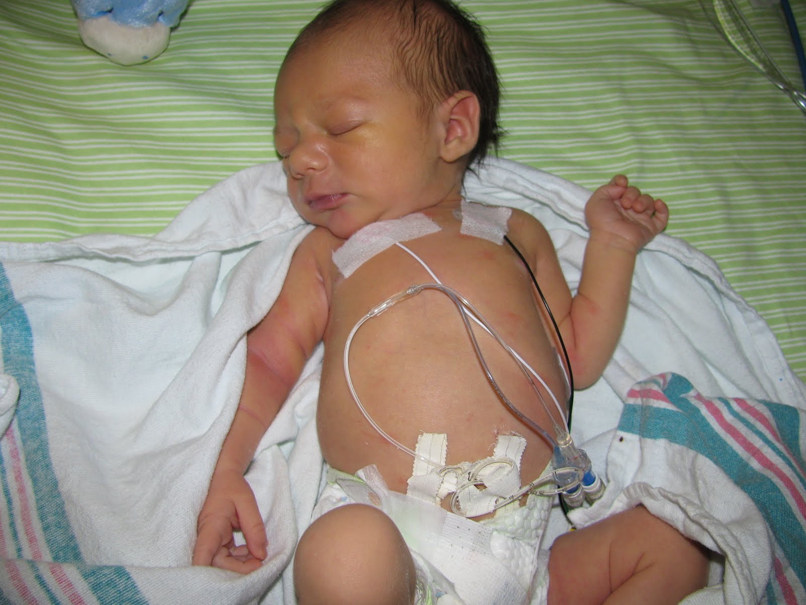 The Carter Family Scars