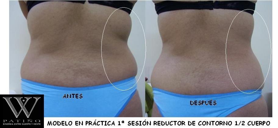 ANTES Y DESPUÉS