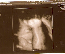 4D Ultrasound 35 weeks