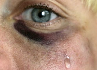 [000085957-5179-330.jpg]