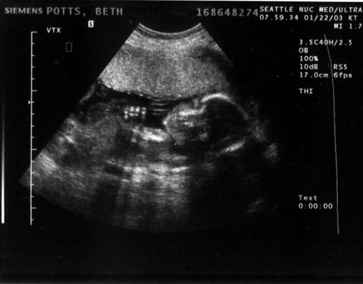 [ultrasound+kid.+doc.jpg]