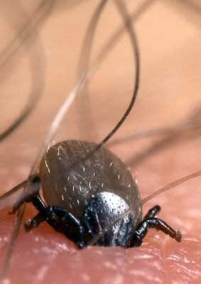 [Tick+-+Burrowing.jpg]