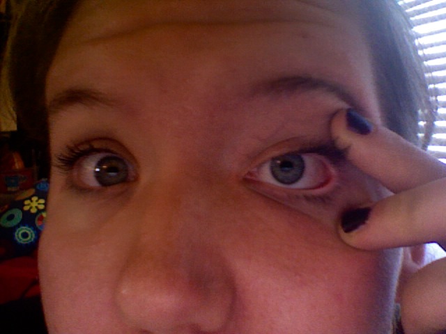 one eye smaller than the other suddenly one eye smaller than the other suddenly