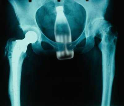 Amazing X-rays