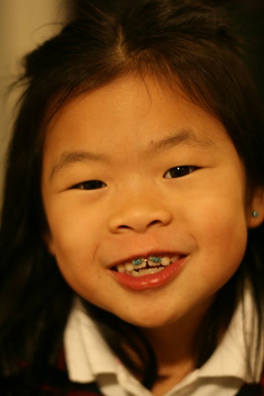 Emma's World Braces!