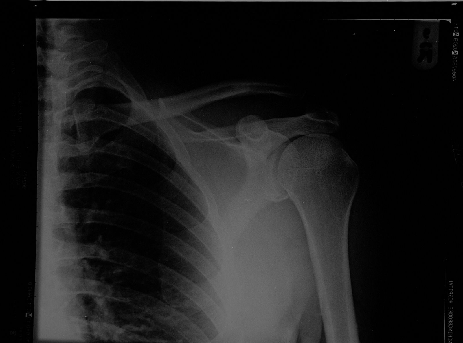 [bones3.jpg]