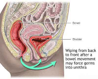 Signs and Symptoms of Cystitis