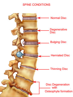lower back pain gal