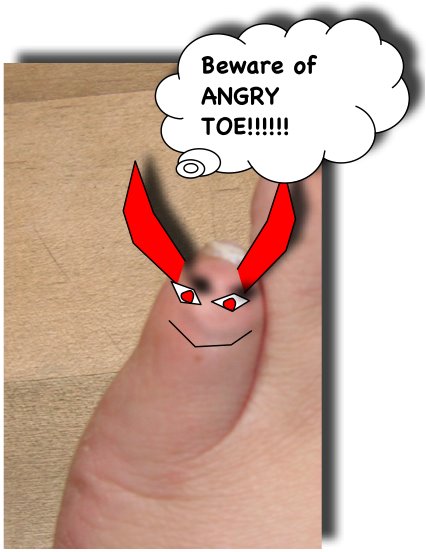 [brokentoeArt.jpg]