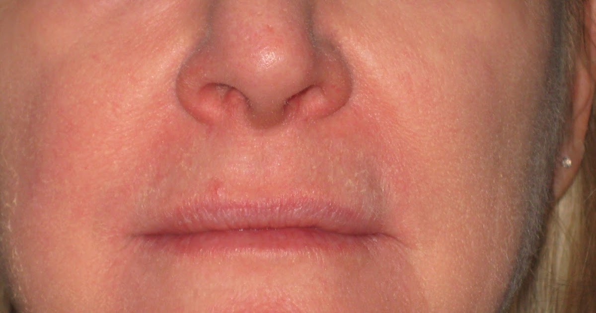 what is the evolutionary purpose of big lips