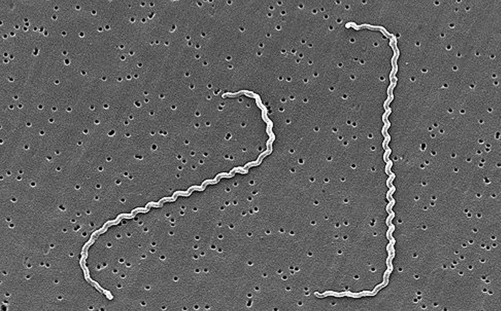 VETERINARY ASSOCIATES OF CAPE COD Leptospirosis