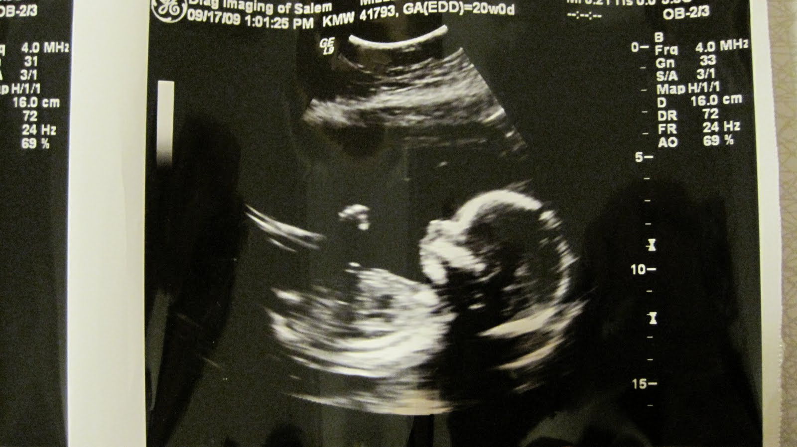 [20weekgirlie.JPG]
