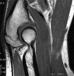 [MRI-Example.jpg]