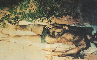 hombre mutilado en brasil (1988) por ¿Aliens? Hombre+Mutilado4