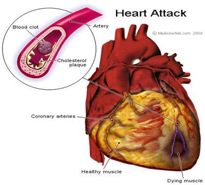 [heart2.bmp]