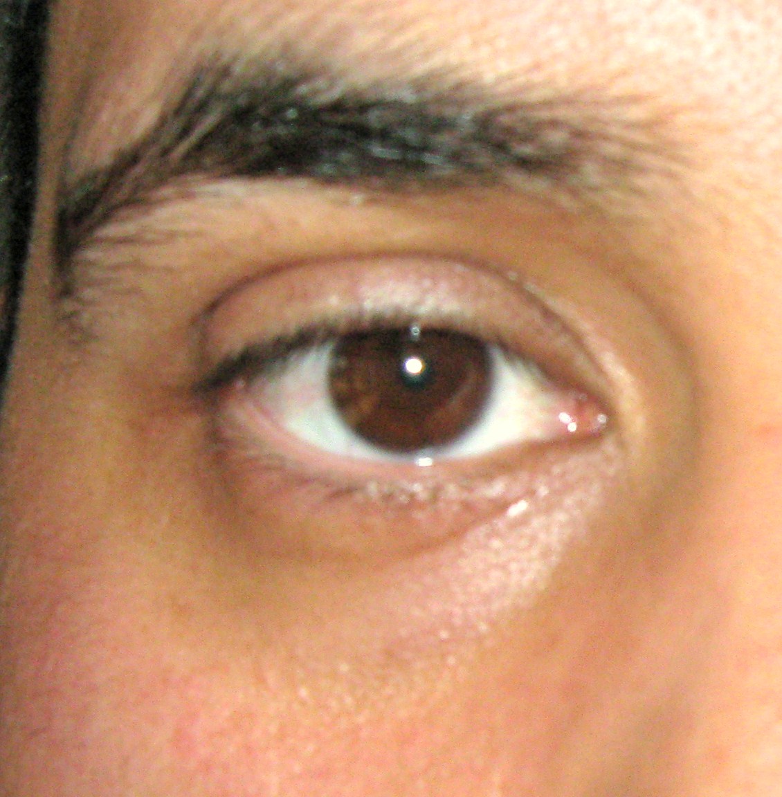 [PHOTO1.jpg]