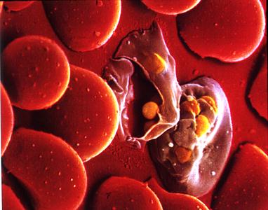 pics of plasmodium