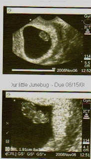 Ultasound, Fetus, New Baby