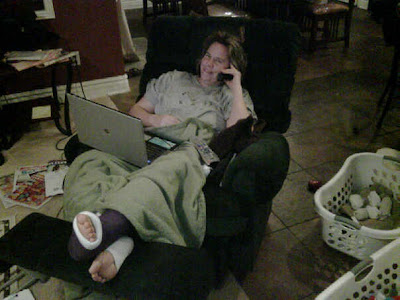 Casted Ankle