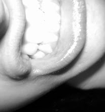 Ouch !