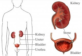 Nephritis Symptoms