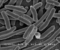 [200px-EscherichiaColi_NIAID.jpg]