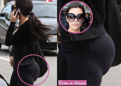 cellulite