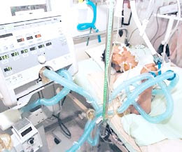 ENTORNO MÉDICO: CETOACIDOSIS DIABETICA ENTORNO MÉDICO: CETOACIDOSIS DIABETICA