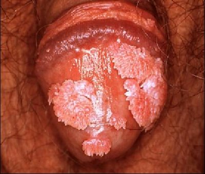 VAGINA ADENTRO vagina adentro: