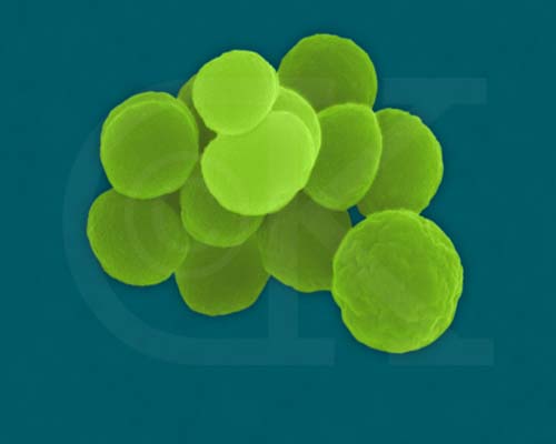 baby with gonorrhea