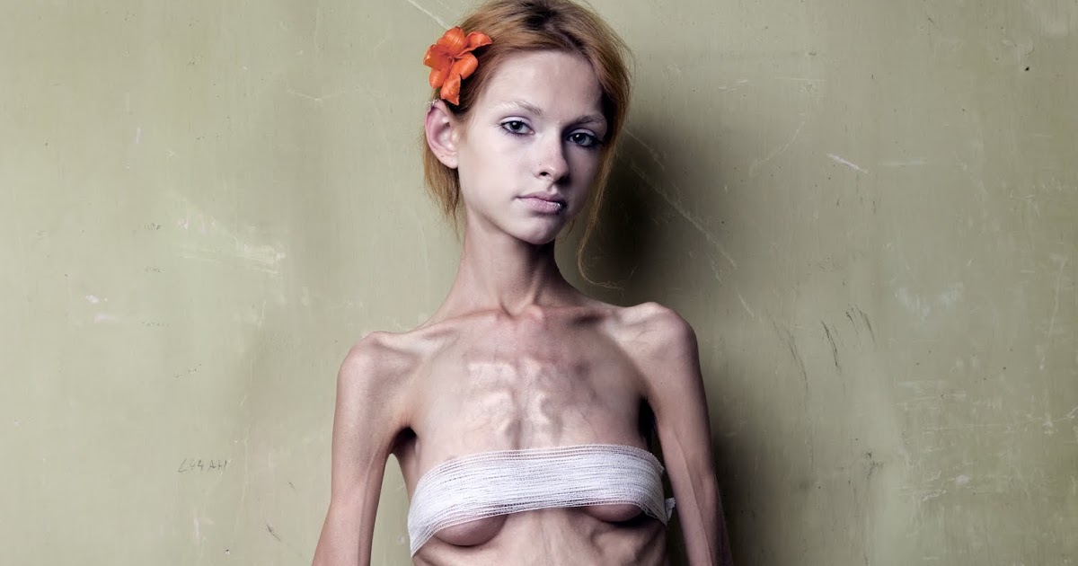 Haunting Anorexic.