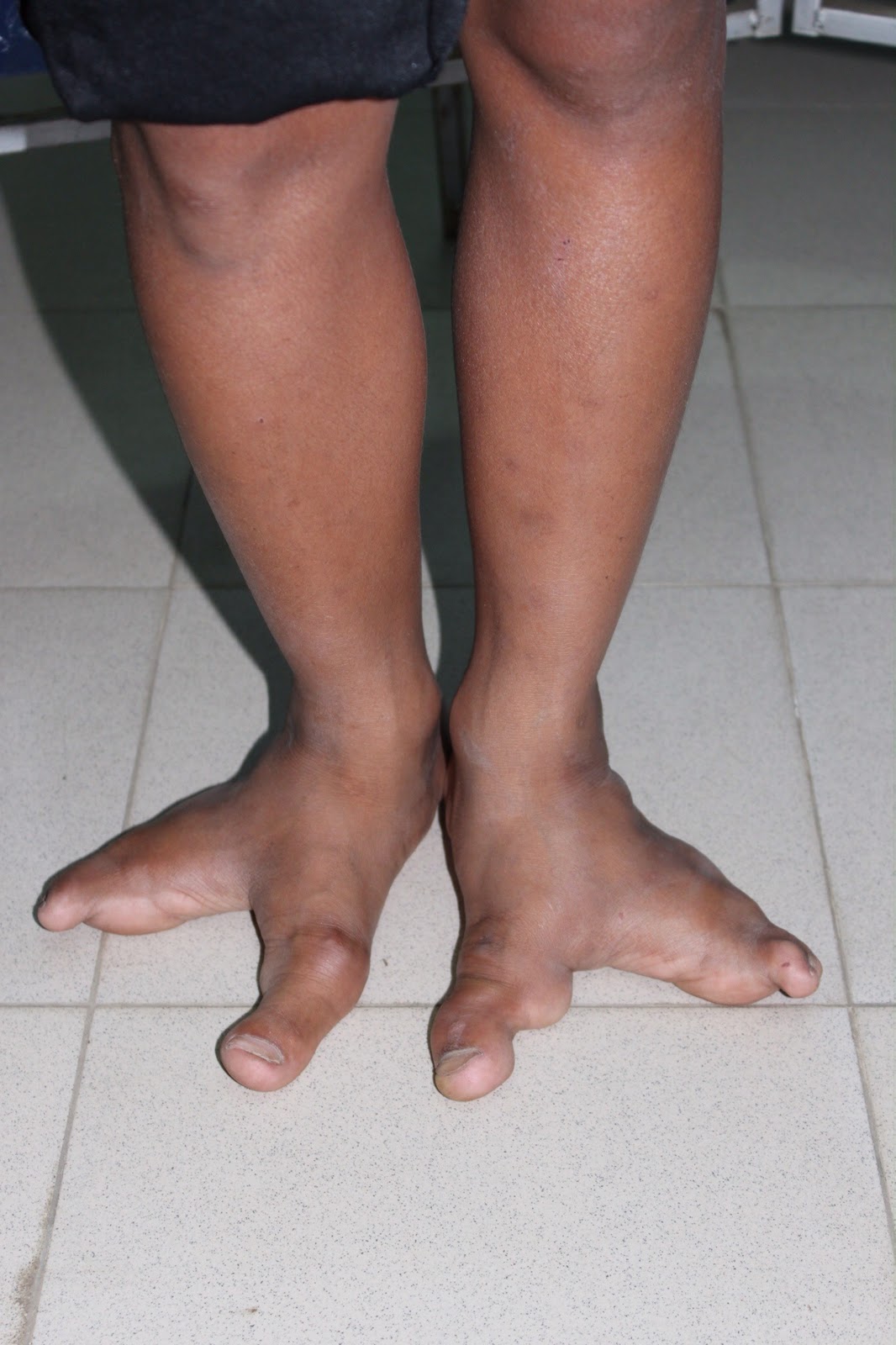 Day 6 At the Hospital